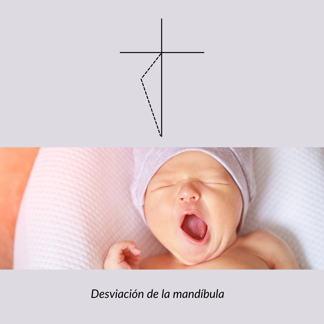 Imagen Bostezo