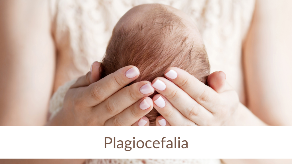 Banner Plagiocefalia